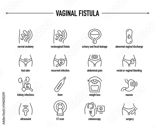 Vaginal Fistula symptoms, diagnostic and treatment vector icon set. Line editable medical icons.