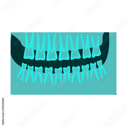 Ray of human upper and lower jaw with teeth vector illustration. Bones of skeleton, roentgen, radiography isolated on white background. Anatomy, medicine, health concept