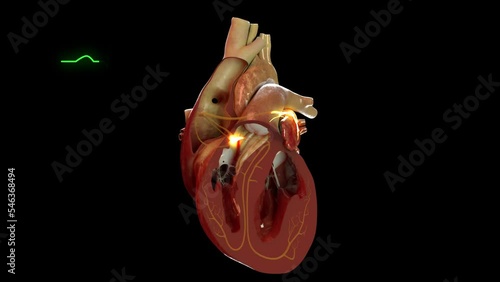 Human heart showing electrical activity in sync with and EGC (EKG)