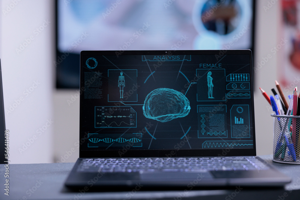 Close up of laptop screen showing analysis results and health status of patient. Neurologist doctor computer on top of desk with pens at medical office in hospital. Brain scanner on notebook monitor. Close up of laptop screen showing analysis results and health status of patient. Neurologist doctor computer on top of desk with pens at medical office in hospital. Brain scanner on notebook monitor.