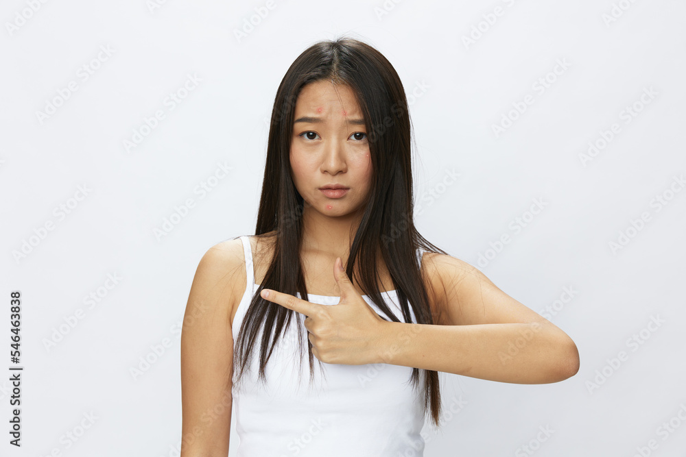 Asian woman hand signals, finger pointing facial skin problems, acne and inflammation, red rash and allergies, chicken pox, sadness from rashes. Facial skin care concept for diseases and nerves Asian woman hand signals, finger pointing facial skin problems, acne and inflammation, red rash and allergies, chicken pox, sadness from rashes. Facial skin care concept for diseases and nerves