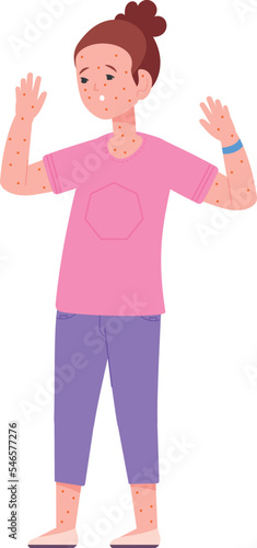 Girl with red body rash. Kid with chicken pox disease