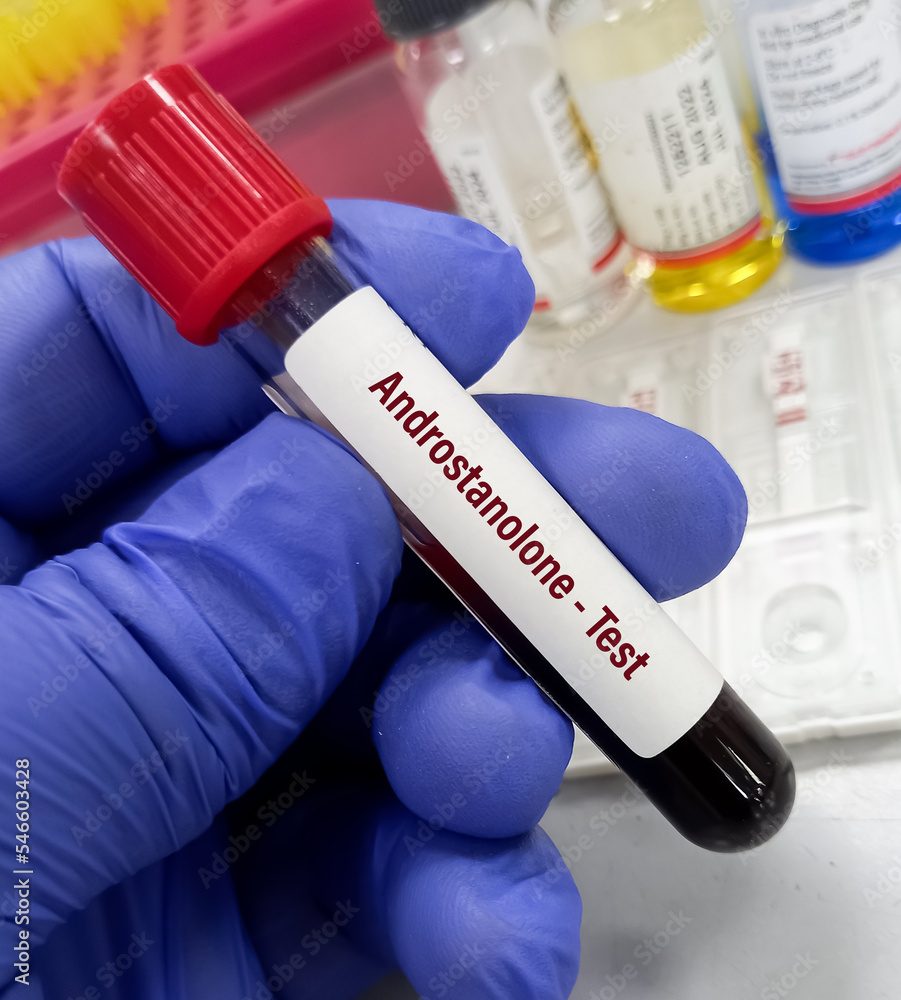 Test tube with blood sample for Androstanolone or Dihydrotestosterone