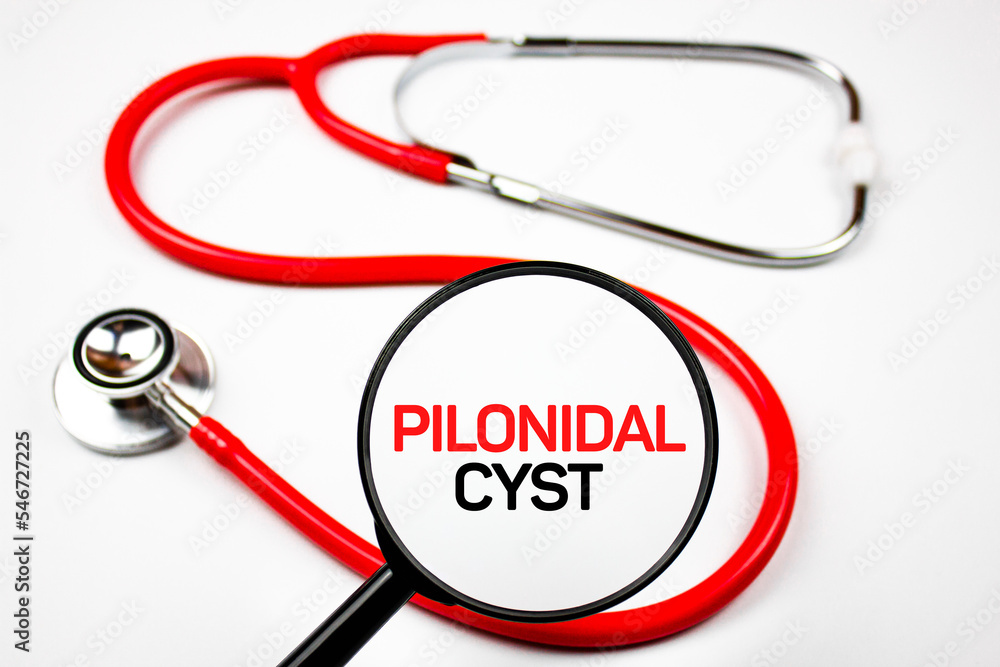 PILONIDAL CYST text concept medical. PILONIDAL CYST text concept medical.
