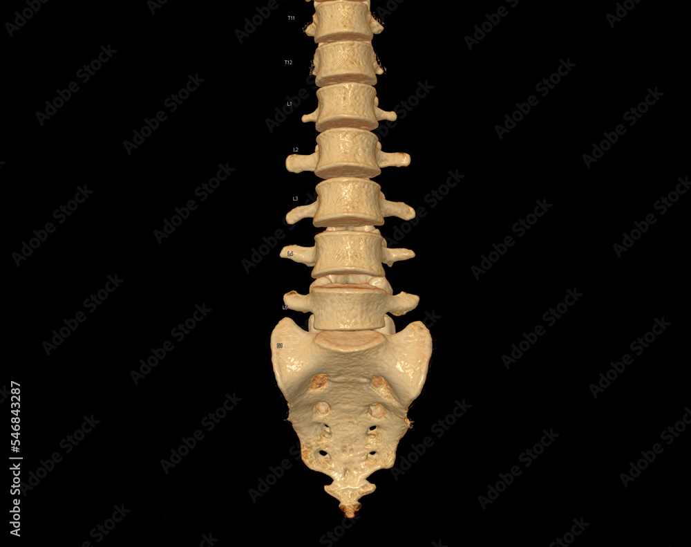 CT scan of Lumbar spine 3D rendering showing Profile Human Spine. Stock ...