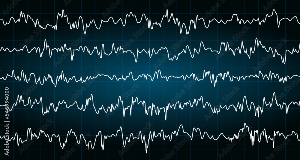 Cardiogram vector background.Heartbeat Cardiogram.Heartbeat line