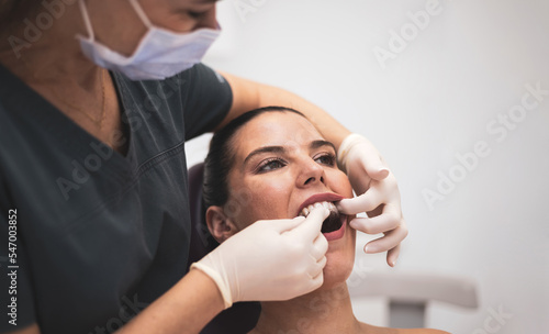 Female dentist putting dental splints on a patient  concept of bruxism  correct bite.