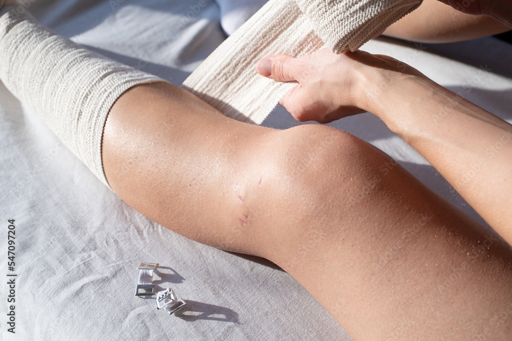 Fototapeta premium Woman sitting on couch putting bandage on leg after knee surgery