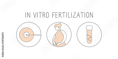 In vitro fertilization icon set. Linear simple illustration pregnancy and fertility. IVF fertilization signs. Vector