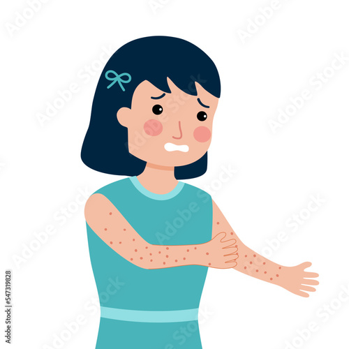 Girl children scratching arm. Kids suffering from strong allergy skin itchy symptom in flat design. Red rash skin irritation.