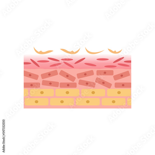 vector illustration of human skin structure anatomy. broken and dry. epidermis and desmis. illustration for science and medical health.