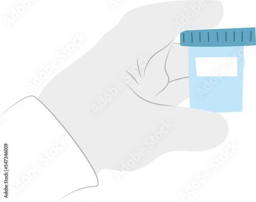 hand in laboratory sterile glove holding a jar with biological probe. Lab specialist demonstrating sample of sperm, stool, urine, mucus.