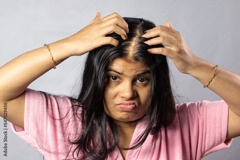 Hair loss Indian woman