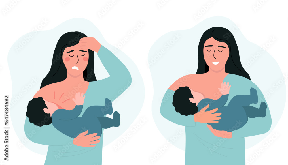 A woman is breastfeeding a baby. The development of inflammation, pain in mastitis. Proper feeding of the child by the mother. Vector graphics.