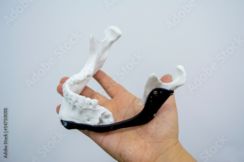 Person holding in hand 3D printed prototype human lower jaw and titanium implant photo
