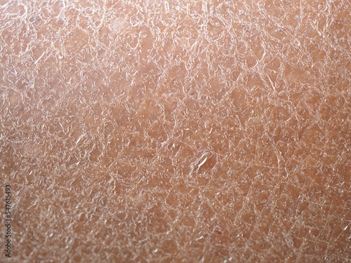 Dry skin or ichthyosis texture detail in women using for moisturizer lotion, cream or beauty product concept, motion. Closeup macro, blurred. photo