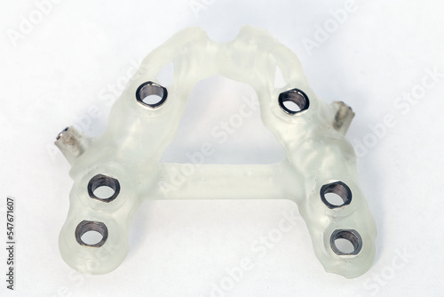 Fotografie Collapsible printed dental surgical template