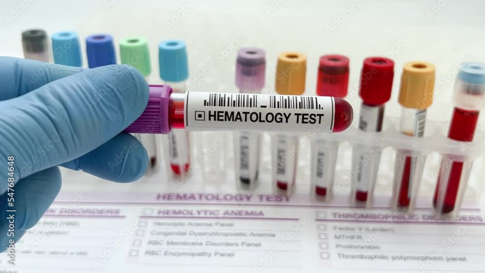 Doctor holding Blood sample tube for analysis in Hematology laboratory. Lab technician assistant or doctor holding a blood testing over requisition report for Hematology test Doctor holding Blood sample tube for analysis in Hematology laboratory. Lab technician assistant or doctor holding a blood testing over requisition report for Hematology test