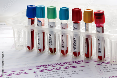 Laboratory tray with collection of blood testing sample tubes for analysis. Rack of tubes with blood samples from patients in the hematology lab photo