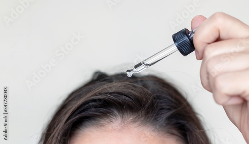 woman applying serum oil on wet hair with pipette or using white comb to disentangle isolated.healthy strong hair,growth stimulation stop fall shiny.top of head forehead lateral view.after pregnancy