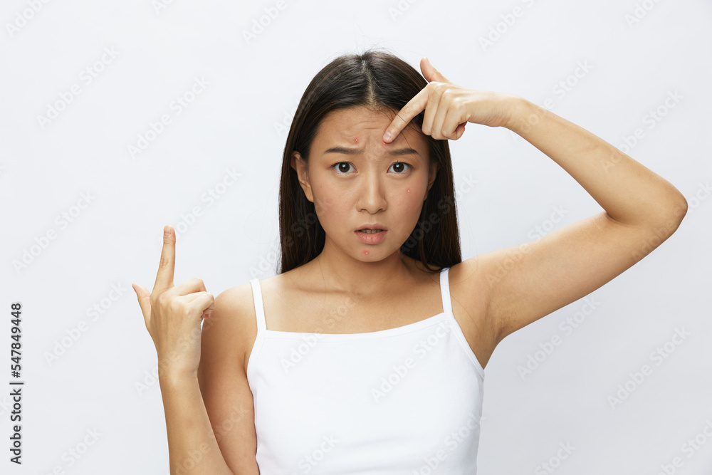 Asian woman facial skin problems, acne and inflammation, red rashes and allergies, chicken pox, sadness from rashes. Facial skin care concept for diseases and nerves Asian woman facial skin problems, acne and inflammation, red rashes and allergies, chicken pox, sadness from rashes. Facial skin care concept for diseases and nerves