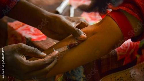 Closeup view of a doctor's hands taking a blood sample from a pregnant lady