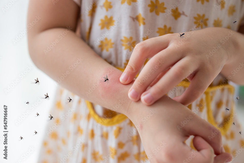 Little girl has skin rash allergy and itchy on her arm from mosquito bite Little girl has skin rash allergy and itchy on her arm from mosquito bite