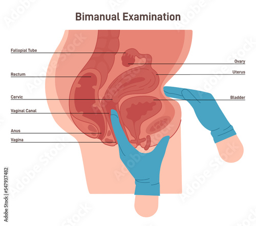 Bimanual examination. Gynecologist check-up. Female pelvic examination
