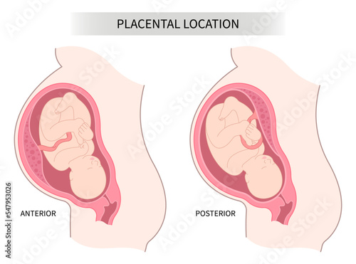 Lateral baby placenta location of pregnancy back fetus Labour death uterine wall intrauterine gender prediction growth restriction prenatal care
