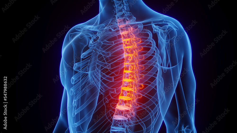3D rendered Medical Illustration of Male Anatomy - Inflamed Thoracic ...
