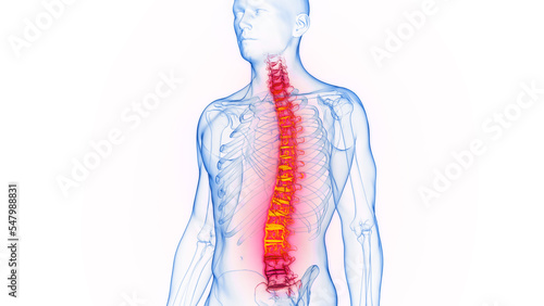 3D rendered Medical Illustration of Male Anatomy - Inflamed Spine.
