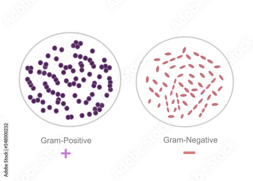The interpretation result of gram-staining technique that showing Gram-Positive and Negative bacteria