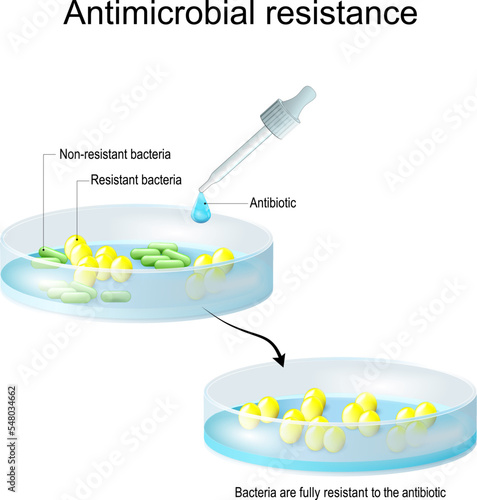 Antimicrobial resistance. Pipette with drop of antibiotic, and petri dish with colony of bacteria.