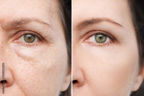 Canvas Print Comparison of the face of young and aged women