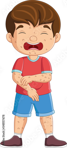 Cartoon sad little boy with chickenpox