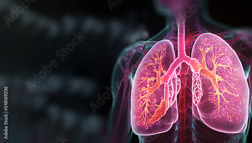 Holographic concept of lung cancer display, lung disease, treatment of lung cancer, lung illness such as pneumonia, viral infections or cancer  3d rendering