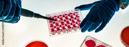 laboratory assistant in a microbiological laboratory doing PCR DNA analysis of biological samples on a 96 well plate photo