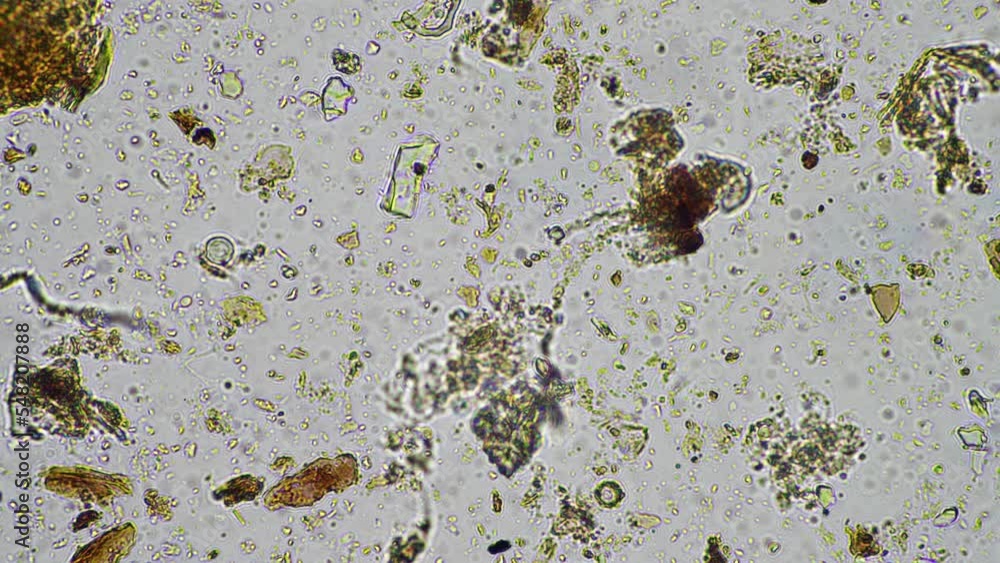 soil microbes organisms in a soil and compost sample, fungus and fungi ...