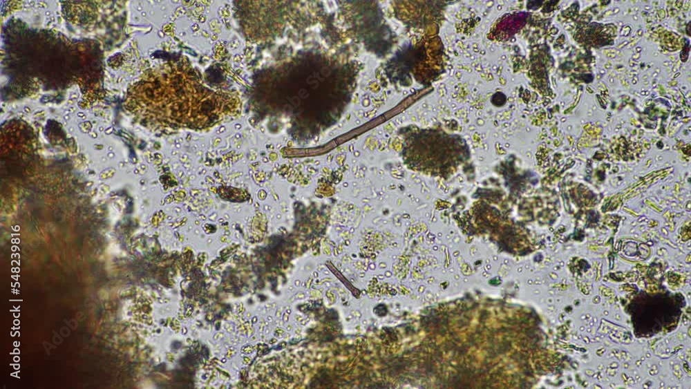 soil microbes organisms in a soil and compost sample, fungus and fungi ...