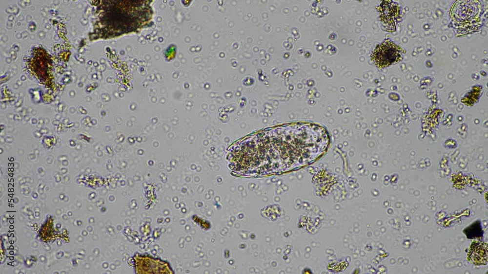 soil microbes organisms in a soil and compost sample, fungus and fungi ...
