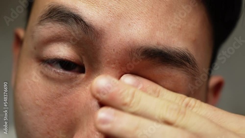 Asian man watching youtube content on mobile phone while rubbing his eyes photo