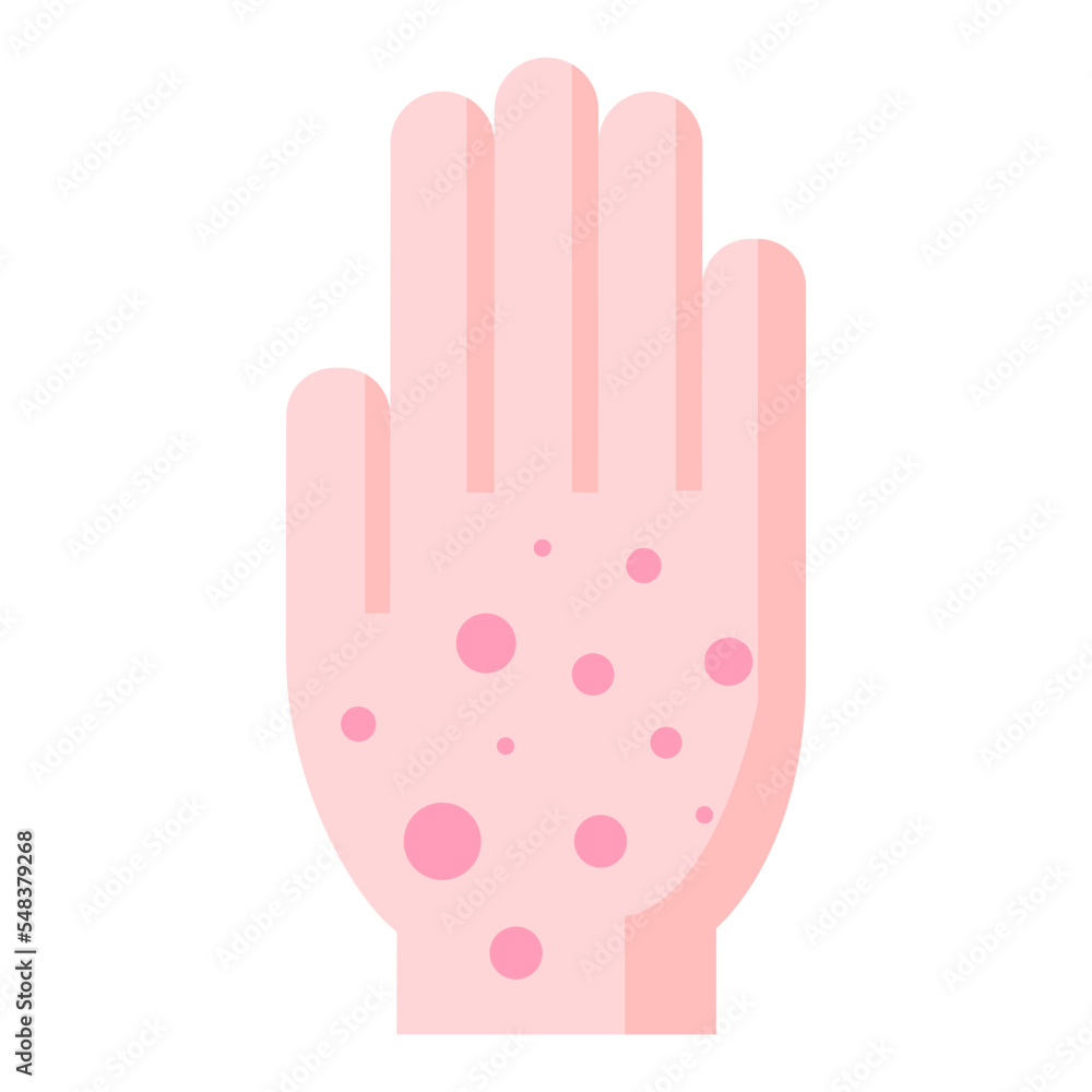 Fototapeta premium Chickenpox icon