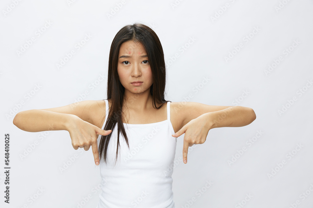 Asian woman hand signals, finger pointing facial skin problems, acne and inflammation, red rash and allergies, chicken pox, sadness from rashes. Facial skin care concept for diseases and nerves Asian woman hand signals, finger pointing facial skin problems, acne and inflammation, red rash and allergies, chicken pox, sadness from rashes. Facial skin care concept for diseases and nerves