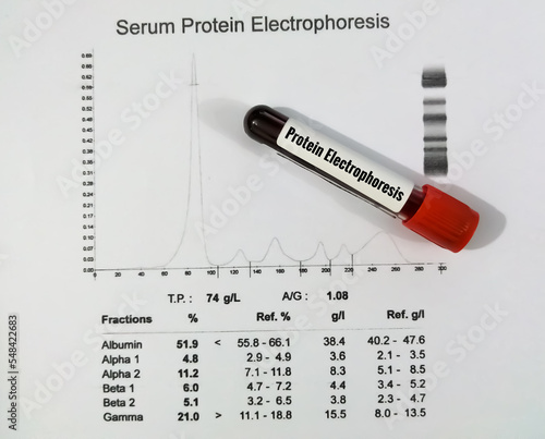 Blood sample and patient's report isolated for Protein Electrophoresis test. Close up. photo