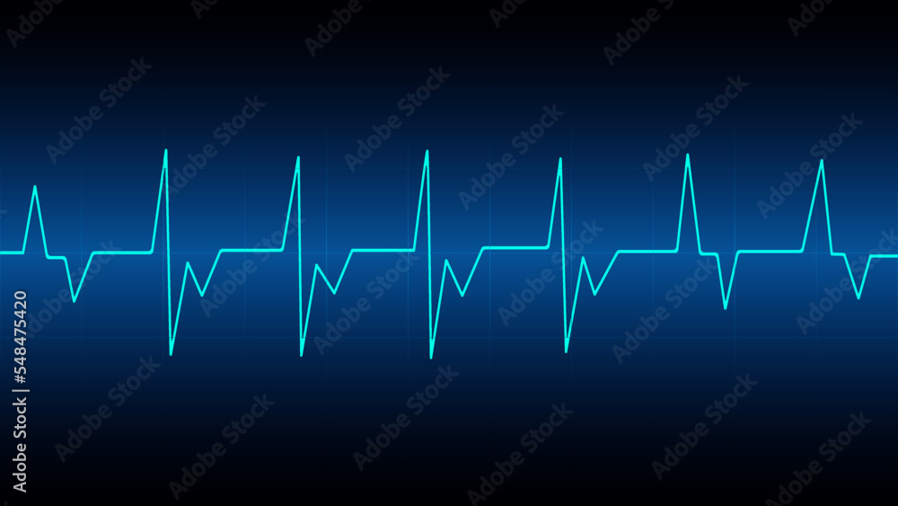 Vector illustration of a cardiogram. Blue background with a heartbeat line. Medicine, pulse, electrocardiogram, heart rate.