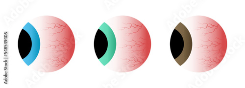 Red eyes side view set. Ill stress, sleep insomnia disorder, capillaries and pupils. Vector illustration.