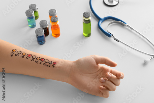 Marked female hand for allergen skin tests, ampules and stethoscope on white background