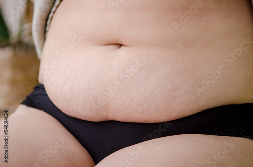 Belly of a young European woman after pregnancy and childbirth. Stretch marks and excess fat. Woman is sitting in black panties