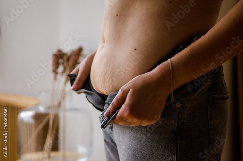 Belly of a young European woman after pregnancy and childbirth. Stretch marks and excess fat. Woman stands with unbuttoned jeans