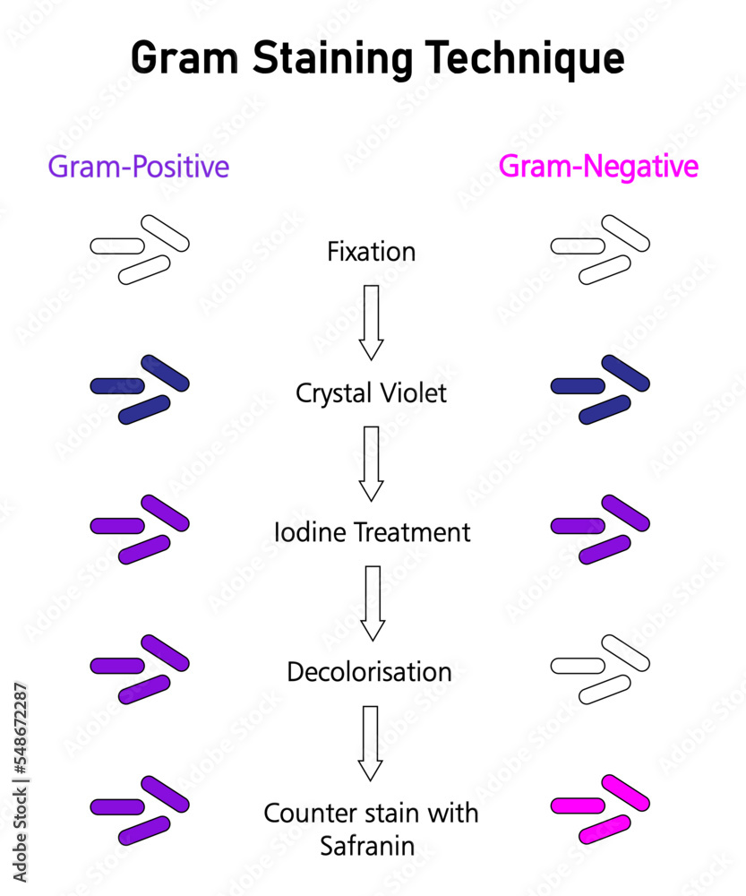 Gram staining technique to identify gram positive and gram negative